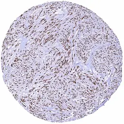 Anti-Mre11 antibody [HMV328] HistoMAX&trade; used in IHC (Paraffin sections) (IHC-P). GTX640560
