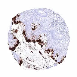 Anti-CA19-9 antibody [HMV333] HistoMAX&trade; used in IHC (Paraffin sections) (IHC-P). GTX640565
