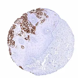 Anti-CA19-9 antibody [HMV333] HistoMAX&trade; used in IHC (Paraffin sections) (IHC-P). GTX640565