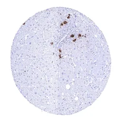 Anti-CA19-9 antibody [HMV333] HistoMAX&trade; used in IHC (Paraffin sections) (IHC-P). GTX640565