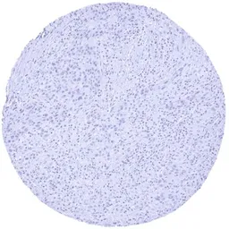 Anti-CA19-9 antibody [HMV333] HistoMAX&trade; used in IHC (Paraffin sections) (IHC-P). GTX640565