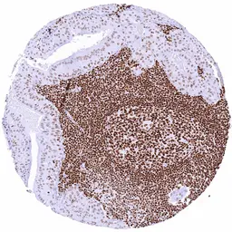 Anti-PARP antibody [HMV334] HistoMAX&trade; used in IHC (Paraffin sections) (IHC-P). GTX640566