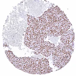 Anti-PARP antibody [HMV334] HistoMAX&trade; used in IHC (Paraffin sections) (IHC-P). GTX640566