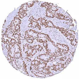 Anti-PARP antibody [HMV334] HistoMAX&trade; used in IHC (Paraffin sections) (IHC-P). GTX640566