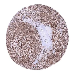 Anti-PARP antibody [HMV334] HistoMAX&trade; used in IHC (Paraffin sections) (IHC-P). GTX640566