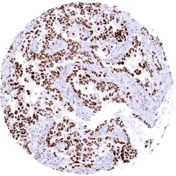 Anti-PARP antibody [HMV334] HistoMAX&trade; used in IHC (Paraffin sections) (IHC-P). GTX640566