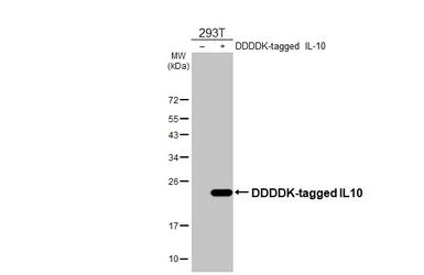Anti-IL10 antibody [HL3118] used in Western Blot (WB). GTX640594