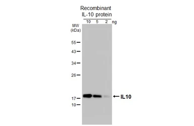 Anti-IL10 antibody [HL3118] used in Western Blot (WB). GTX640594