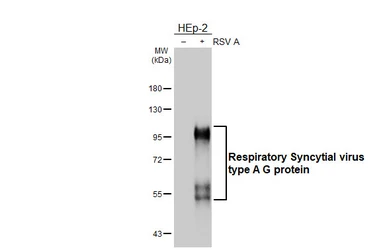 Anti-Respiratory Syncytial virus type A G protein antibody [HL3122] used in Western Blot (WB). GTX640598