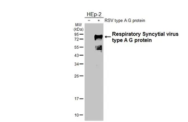 Anti-Respiratory Syncytial virus type A G protein antibody [HL3122] used in Western Blot (WB). GTX640598