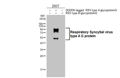 Anti-Respiratory Syncytial virus type A G protein antibody [HL3122] used in Western Blot (WB). GTX640598