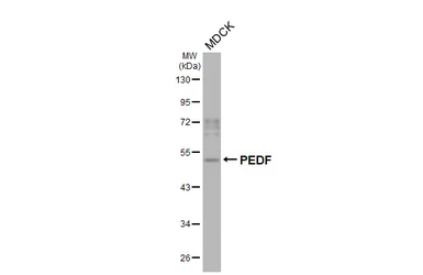 Anti-PEDF antibody [HL3123] used in Western Blot (WB). GTX640609