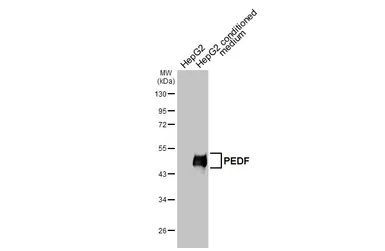 Anti-PEDF antibody [HL3123] used in Western Blot (WB). GTX640609