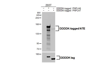 Anti-NTE antibody [HL3127] used in Western Blot (WB). GTX640613
