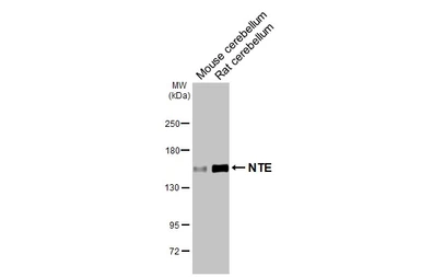 Anti-NTE antibody [HL3127] used in Western Blot (WB). GTX640613