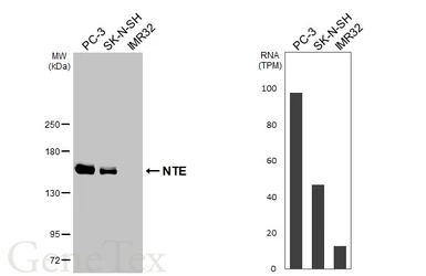 Anti-NTE antibody [HL3127] used in Western Blot (WB). GTX640613