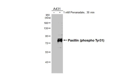 Anti-Paxillin (phospho Tyr31) antibody [HL3129] used in Western Blot (WB). GTX640615