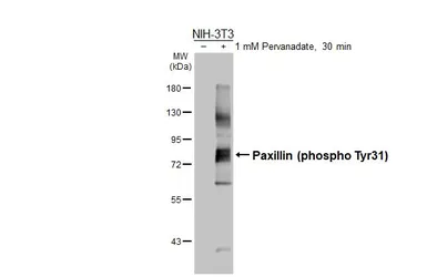 Anti-Paxillin (phospho Tyr31) antibody [HL3129] used in Western Blot (WB). GTX640615