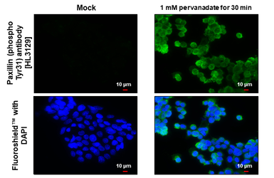 Anti-Paxillin (phospho Tyr31) antibody [HL3129] used in Immunocytochemistry/ Immunofluorescence (ICC/IF). GTX640615
