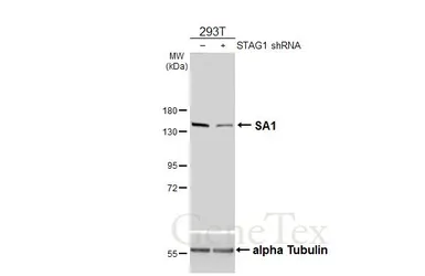 Anti-SA1 antibody [HL3139] used in Western Blot (WB). GTX640631