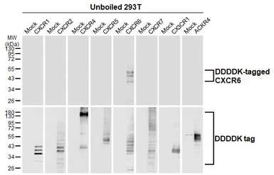 Anti-CXCR6 antibody [HL3144] used in  (). GTX640636