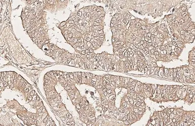 Anti-CXCR6 antibody [HL3144] used in IHC (Paraffin sections) (IHC-P). GTX640636