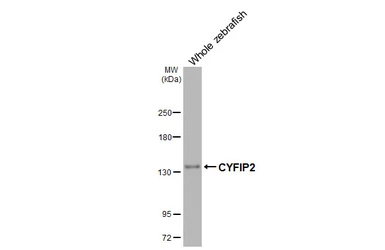 Anti-CYFIP2 antibody [HL3148] used in Western Blot (WB). GTX640658