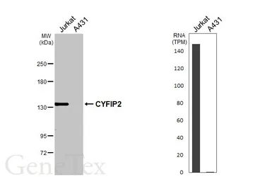 Anti-CYFIP2 antibody [HL3148] used in Western Blot (WB). GTX640658