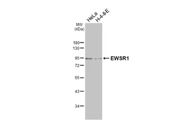 Anti-EWSR1 antibody [HL3150] used in Western Blot (WB). GTX640660