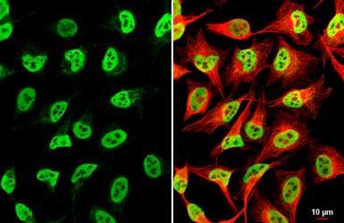 Anti-EWSR1 antibody [HL3150] used in Immunocytochemistry/ Immunofluorescence (ICC/IF). GTX640660