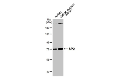 Anti-SP2 antibody [HL3155] used in Western Blot (WB). GTX640665