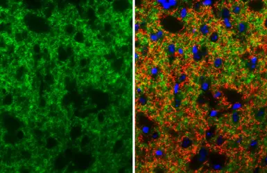 Anti-Dopamine Receptor D2 antibody [HL3159] used in IHC (Paraffin sections) (IHC-P). GTX640669