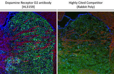 Anti-Dopamine Receptor D2 antibody [HL3159] used in IHC (Frozen sections) (IHC-Fr). GTX640669
