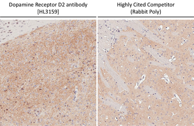 Anti-Dopamine Receptor D2 antibody [HL3159] used in IHC (Paraffin sections) (IHC-P). GTX640669
