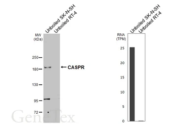 Anti-CASPR antibody [HL3160] used in Western Blot (WB). GTX640670