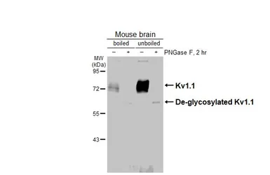 Anti-Kv1.1 antibody [HL3162] used in Western Blot (WB). GTX640672
