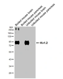 Anti-Kv1.2 antibody [HL3163] used in Western Blot (WB). GTX640673