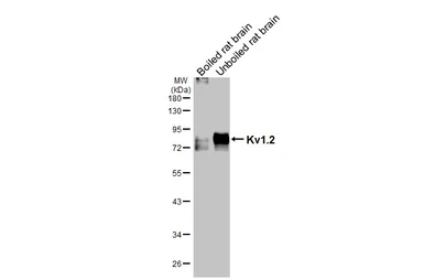 Anti-Kv1.2 antibody [HL3163] used in Western Blot (WB). GTX640673