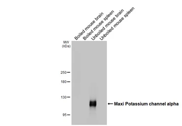 Anti-Maxi Potassium channel alpha antibody [HL3164] used in Western Blot (WB). GTX640674