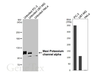Anti-Maxi Potassium channel alpha antibody [HL3164] used in Western Blot (WB). GTX640674