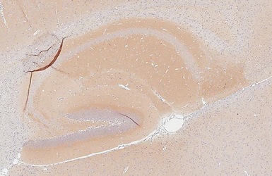 Anti-PSD95 antibody [HL3165] used in IHC (Paraffin sections) (IHC-P). GTX640675