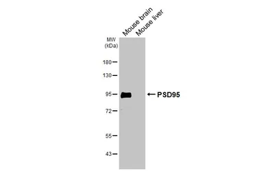 Anti-PSD95 antibody [HL3165] used in Western Blot (WB). GTX640675