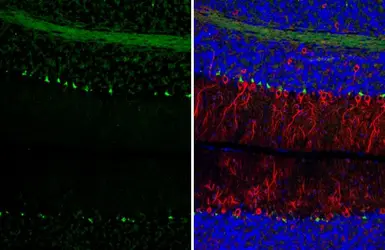 Anti-PSD95 antibody [HL3165] used in IHC (Paraffin sections) (IHC-P). GTX640675
