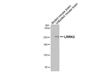 Anti-LRRK2 antibody [HL3167] used in Western Blot (WB). GTX640677
