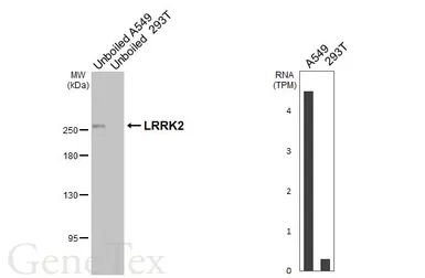 Anti-LRRK2 antibody [HL3167] used in Western Blot (WB). GTX640677
