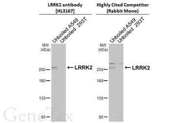 Anti-LRRK2 antibody [HL3167] used in Western Blot (WB). GTX640677