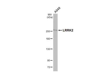 Anti-LRRK2 antibody [HL3167] used in Western Blot (WB). GTX640677