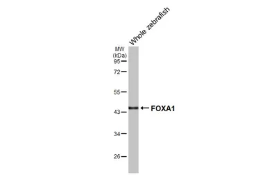Anti-FOXA1 antibody [HL3168] used in Western Blot (WB). GTX640686