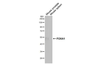 Anti-FOXA1 antibody [HL3168] used in Western Blot (WB). GTX640686
