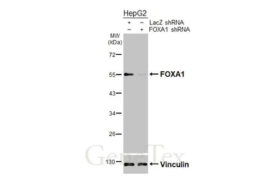 Anti-FOXA1 antibody [HL3168] used in Western Blot (WB). GTX640686